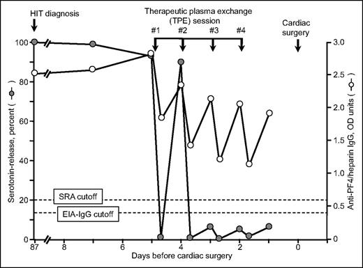 Figure 3. Serial SRA and IgG-specific anti-PF4/heparin EIA test results in relation to 4 therapeutic plasma exchange sessions performed on 4 consecutive days (last therapeutic plasma exchange performed 2 days before cardiac surgery using heparin). This is patient 21 in Table 1. Reprinted from Warkentin et al32 with permission.
