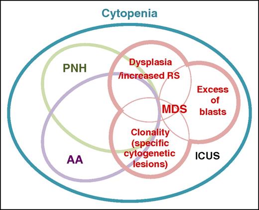 Figure 2. Overlaps between AA, PNH, and MDS. Although conceptually representing discrete disease entities, AA, PNH, and MDS frequently coexist or show mutual transitions within a same patient, apart from the ambiguity in actual diagnosis due to the lack of conclusive evidence or misdiagnosis because of resembling clinical presentations. Immune-mediated BM destruction can occur at the same time of emergence of PNH or evolution of malignant clones, causing a diagnostic overlap between these different disease concepts. Increased ring sideroblasts (RS) are rarely seen in AA. ICUS, idiopathic cytopenia of undetermined significance.