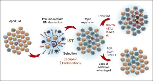Figure 4. A possible model for clonal evolution in AA. Upon immune-mediated destruction of BM, some clones are thought to be resistant to the inciting autoimmune insult and/or show faster cycling/less apoptosis than others upon BM recovery to achieve a clonal dominance. In some cases, the dominant clones, especially those having DNMT3A, ASXL1, and other unfavorable mutations, increase their clone size, giving rise to more selectively dominant clones therein. In other cases, typically those carrying PIGA mutations (and possibly BCOR/BCOR mutations), initially dominant clones may regress or remain stable over years.