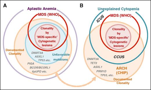 Figure 6. Clonality and MDS diagnosis in AA and other refractory cytopenia. (A) Clonality (orange) is common (>50%) in AA when assessed by gene mutations and other genetic lesions, such as cytogenetic abnormalities, using advanced genomics. However, the clonal evolution does not necessarily mean the development of diseases, especially malignant ones, such as MDS. According to the current World Health Organization (WHO) criteria, patients with AA are diagnosed as having MDS when cytopenia is present and clonality is evidenced by MDS-specific cytogenetic abnormalities, such as monosomy 7, even in the absence of dysplasia or increased blast counts (pink circle). Their clone size is not relevant as long as they are found at ≥2 metaphases. On the other hand, not all clonality is associated with MDS diagnosis (and vice versa). For example, isolated abnormalities of trisomy 8, del(20q), and –Y, are not considered to be sufficient evidence of MDS diagnosis without morphological evidence or increased blast counts, because these isolated lesions may be found in normal individuals and do not likely to correlate with typical MDS pictures. Similarly, without other evidence of MDS, somatic mutations, including those affecting common targets of myeloid malignancies, are not thought to be evidence of malignant clonal evolution by themselves. In fact, in many AA cases, somatic mutations or other clonality can be compatible with normal or almost normal blood counts. By contrast, patients with unfavorable mutations (blue circle) are more likely to show poor prognosis and to satisfy the WHO criteria for MDS/AML during their clinical course than patients with other mutations. (B) A parallel relationship is also found in unexplained cytopenia in the general population. According to the WHO criteria, the clonality (cytogenetic) criteria of MDS are reserved for MDS-specific lesions, which suffice for the diagnosis of MDS, even without evidence of dysplasia or increased blast counts. Those patients with unexplained refractory cytopenia having no evidence of MDS (between red and blue circles) are designated as ICUS. Some ICUS patients show evidence of clonal evolution (CCUS), and recent reports have suggested some similarity between CCUS and MDS (see main text), for which further confirmation is needed. CCUS, clonal ICUS.