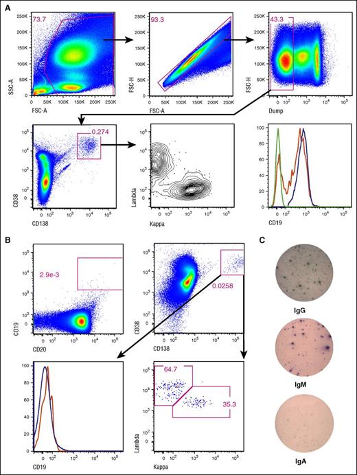 Figure 2. CD19− bone marrow PCs resist elimination by CTL019. (A) Bone marrow aspirate from healthy donors were stained and analyzed by flow cytometry. The bottom right panel shows CD19 expression on CD138+CD38+ PCs (red) and CD20+CD19+ cells (blue); the green histogram represents CD138+CD38+ cells with fluorescence-minus-one (CD19) staining. Representative data from 7 donors are shown. The “dump” channel contains stains for viability, CD3, CD14, and CD16. (B) Bone marrow aspirate cells from CHP-11 on day 28 post-CTL019 infusion were analyzed as in panel A. Gating for B cells (top left), PCs (top right) is shown. The bottom left panel shows CD19 expression on CD38+CD138+ cells (red histogram) and on all singlet events in the forward (FSC) and side scatter (SSC) gate (blue histogram). In both panels A and B, expression of light chains was assessed by intracellular staining. (C) Two hundred thousand cells from the aspirate material shown in panel B were plated in ELISPOT wells, which were stained for total IgG, IgM, and IgA after overnight incubation.