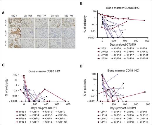 Figure 3. Immunohistochemical analysis demonstrates long-term presence of bone marrow PCs and B-cell aplasia after CTL019 treatment. (A) Bone marrow core biopsies from subject UPN-1 at baseline and serial time points post-CTL019 infusion were stained, separately, for CD138, CD20, and CD19 by IHC. Representative regions at ×20 magnification are shown. (B-E) The frequency of CD138+ (B), CD20+ (C), and CD19+ cells (D) among total nucleated cells in bone marrow biopsies from adult (red curves) and pediatric (blue curves) patients was determined by digital image analysis for the indicated time points pre- and post-CTL019.