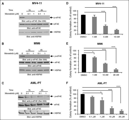 Figure 1. Merestinib blocks phosphorylation of eIF4E and suppresses growth of primary leukemic progenitors from AML patients. (A) MV4-11 cells, (B) MM6 cells, and (C) AML patient-derived cells (AML-PT) were incubated with merestinib (LY2801653) at final concentrations of either 0.1 or 1 µM for 1 and 4 hours. Cell lysates were resolved by sodium dodecyl sulfate-polyacrylamide gel electrophoresis and immunoblotted with an antibody against the phosphorylated form of eIF4E on serine 209. The same blots were stripped and reprobed with an antibody against eIF4E. The immunoblots were also probed for HSP90 as a loading control. (D) MV4-11 and (E) MM6 cells were plated in clonogenic assays in methylcellulose with increasing concentrations of merestinib (LY2801653), as indicated. Data are expressed as percentage of colony formation of control vehicle-treated cells, and bar graphs represent means ± standard error (SE) of 5 independent experiments. (F) Dose-dependent suppression of primary leukemic precursors from AML patients by merestinib in clonogenic assays in methylcellulose. Data are expressed as percentage of colony formation of control vehicle-treated cells. Bar graphs represent means ± SE from 5 independent experiments, using cells from 5 different patients with AML. One-way ANOVA analysis followed by Tukey’s test was used to evaluate statistically significant differences: *P < .05, ****P < .0001.