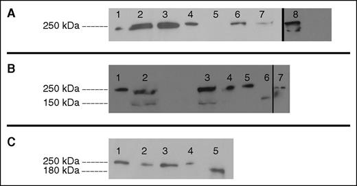 Figure 4. Western blot analysis of plasma and recombinant VWF. (A) Family 1 plasma shows thick bands unable to separate potential low concentrations of mutants from similarly sized WT VWF. Lane 1, NPP. Lane 2, Patient V69 plasma. Lane 3, Patient V70 plasma. Lane 4, Recombinant WT VWF. Lane 5, Recombinant 23del VWF. Lane 6, Recombinant 26del VWF. Lane 7, Recombinant 23/26del VWF. Lane 8, Recombinant 23del lysate. (B) Family 2 plasma exhibits an additional band which size corresponds to 33del; 33-34del did not significantly separate from WT VWF. Lane 1, Recombinant WT VWF. Lane 2, Patient T151 plasma. Lane 3, Patient T152 plasma. Lane 4, NPP. Lane 5, Recombinant WT VWF. Lane 6, Recombinant 33del VWF. Lane 7, Recombinant 33-34del VWF. (C) Family 3 plasma shows no additional bands other than WT VWF. Lane 1, NPP. Lane 2, Patient V447 plasma. Lane 3, Patient V449 plasma. Lane 4, Recombinant WT VWF. Lane 5, Recombinant 38del VWF.