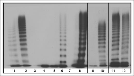 Figure 6. Multimers from recombinant WT and mutant VWF splice variants secreted from HEK293T cells. 100% indicates homozygous transfections; 50% indicates transfections in the mock heterozygous state where HEK293T cells were transfected with 50% WT vector and 50% mutant vector. Lane 1, Abnormal 2A control. Lane 2, NPP control. Lane 3, 100% 23del. Lane 4, 50% 23del. Lane 5, 100% 26del. Lane 6, 50% 26del. Lane 7, 100% 23/26del. Lane 8, 50% 23/26del. Lane 9, 100% 33del. Lane 10, 50% 33 del. Lane 11, 100% 33-34del. Lane 12, 50% 33-34del.