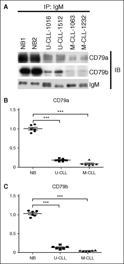 Figure 2. Impaired assembly of IgM with CD79a and CD79b in CLL samples. (A) Human normal naïve B-cell samples (n = 6), U-CLL cell samples (n = 6), and M-CLL cell samples (n = 6) were extracted in digitonin buffer. IgM protein was immunoprecipitated, and IgM-associated CD79a and CD79b proteins were examined by immunoblot. Membranes were stripped and reprobed with anti-IgM antibody as a loading control. The results in (B-C) represent the relative association of CD79a and CD79b to IgM in U-CLL and M-CLL cell samples (lines represent mean ± SEM of 6 samples), with total IgM-associated CD79a or CD79b protein in human normal naïve B-cell samples set at “1” (lines represent mean ± SEM of 6 samples). The values of IgM-associated CD79a and CD79b are normalized to anti–IgM-precipitated IgM in all samples. The results in (A) show 1 representative experiment with 2 samples of each population. ***P < .005. IB, immunoblot; IP, immunoprecipitated; NB, naïve B cell.