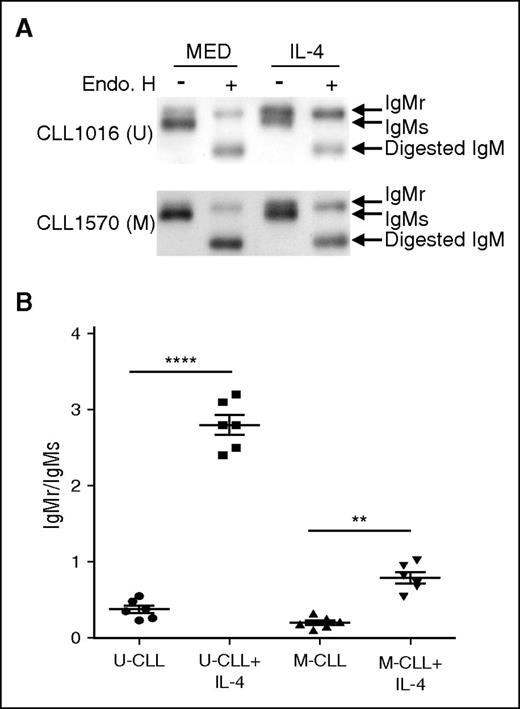 Figure 5. IL-4 promotes IgM maturation in CLL cells. (A-B) IL-4 promotes IgM maturation in CLL samples. U-CLL cells (A, top) and M-CLL cells (A, bottom) were cocultured in the presence (IL-4) or absence (MED) of IL-4 (25 ng/mL) for 48 hours. Viable CLL cells were sorted and lysed in NP-40 buffer. Cell lysates were subjected to endo H digestion followed by immunoblot using anti-IgM antibody to identify endo H-resistant (IgMr) and endo H-sensitive (IgMs) species. The summarized results in (B) represent ratios of IgMr to IgMs in U-CLL and M-CLL cell samples, with or without IL-4 (lines represent mean ± SEM of 6 samples). The results in (A) show 1 representative experiment with 1 U-CLL sample and 1 M-CLL sample. **P < .01; ****P < .001.