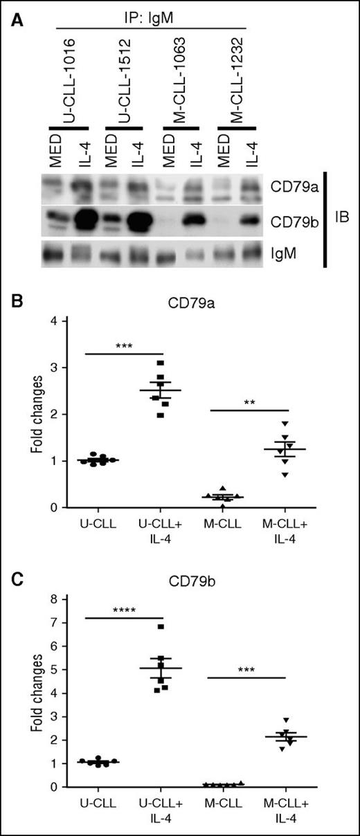 Figure 6. IL-4 recovers assembly of IgM-BCR complexes. (A) U-CLL and M-CLL samples were cocultured in the presence (IL-4) or absence (MED) of IL-4 (25 ng/mL) for 48 hours. Viable CLL cells were sorted and extracted in digitonin buffer. IgM protein was immunoprecipitated, and IgM-associated CD79a and CD79b proteins were examined by immunoblot. Membranes were stripped and reprobed with anti-IgM antibody as a loading control. The summarized results in (B-C) represent the relative association of CD79a and CD79b to IgM in U-CLL and M-CLL cell samples with or without IL-4 (lines represent mean ± SEM of 6 samples), with total IgM-associated CD79a or CD79b protein in U-CLL samples set at “1” (lines represent mean ± SEM of 6 samples). The values of IgM-associated CD79a and CD79b are normalized to anti–IgM-precipitated IgM in all samples. The results in (A) show 1 representative experiment with 2 samples of each population. **P < .01; ***P < .005; ****P < .001. IB, immunoblot; IP, immunoprecipitated.