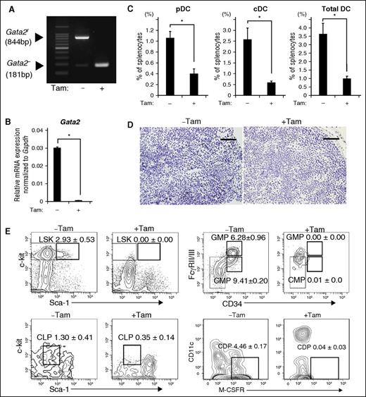 Figure 2. Drastically reduced numbers of splenic DCs and BM progenitor cells in Gata2 knockout mice. (A) Gata2 deletion was confirmed via PCR analysis of genomic DNA isolated from total BM cells of mice injected with tamoxifen or corn oil. (B) Relative levels of Gata2 mRNA in BM cells of mice injected with tamoxifen or corn oil. Data are expressed as means ± SDs (n = 4). *P < .01. (C) Percentages of splenic DC populations (pDCs and cDCs) among splenocytes from Gata2f/f/ER-Cre mice injected with tamoxifen or corn oil were determined using flow cytometry. Data are expressed as means ± SDs (n = 4). *P < .01. (D) Immunohistochemical analysis of spleens from Gata2f/f/ER-Cre mice treated with tamoxifen or corn oil. Sections were stained with an antibody against CD11c (CD11c+ cells are brown). Scale bar, 50 μm. (E) Percentages of BM progenitor cells from Gata2f/f/ER-Cre mice injected with tamoxifen or corn oil were determined using flow cytometry. Data are expressed as means ± SDs (n = 4). All differences are significant (P < .005).