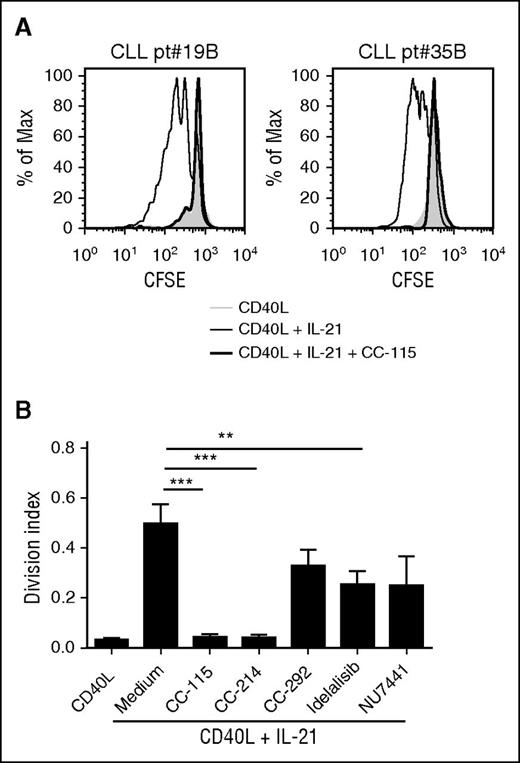 Figure 5. CC-115 and mTOR inhibitors block proliferation of CLL cells. (A) CFSE-labeled CLL cells were cultured on fibroblast expressing CD40L with (black line) or without (gray) IL-21 and cotreated with 1 µM CC-115 (thick black line). After 4 days, CFSE was measured by FACS. Results are shown as representative histograms for 2 patients. (B) Division index was calculated with the FlowJo program. Results are shown as mean ± SEM (n = 11; patients 2C, 19B, 20, 35B, 71, and 78-82). *P < .05, **P < .01, ***P < .001 (1-way ANOVA).