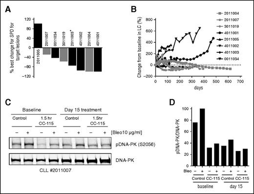 Figure 7. CC-115 decreases lymphadenopathy in CLL patients. (A) Best percentage change in sum of product of diameters for target lesions for patients with single ATM deletion (black) and those with likely or potentially deleterious mutation in remaining ATM allele (gray). *Patient had Richter’s syndrome diagnosed at the same time. (B) Changes in lymphocyte counts of patients with single ATM deletion (black) and those with likely or potentially deleterious mutation in remaining ATM allele (gray) (supplemental Table 2) during CC-115 treatment over time. (C) Western blot analysis of phospho- and total DNA-PK in PBMCs from CC-115-ST-001 patient 2011007. PBMCs in plasma were collected at screening, cycle 1 day 1/baseline (before and 1.5 hours after CC-115 dose), and cycle 1 day 15 (before and 1.5 hours after CC-115 dose). PBMCs in plasma were incubated with or without 10 µg/mL bleomycin for 60 minutes. Total and phospho-DNA-PK was detected by western blot analysis of protein lysates. (D) Quantification of the western blots in C.