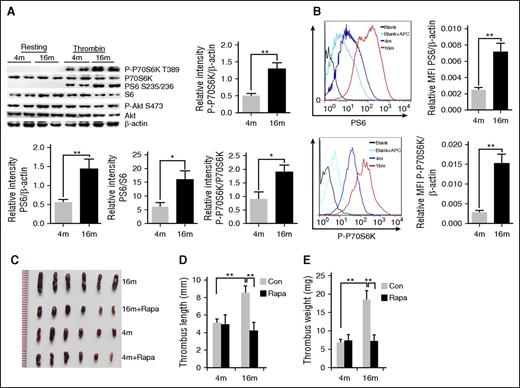 Figure 1. Enhanced mTORC1 activity in MKs and platelets is associated with age-related increased susceptibility to VTE in mice. (A) Platelets isolated from 4- and 16-month-old mice were stimulated with thrombin (0.2 U/mL) and subjected to western blot analysis for mTORC1 (P-S6, P-P70S6K) and mTORC2 (P-Akt) activities (n = 16). Relative values are provided for immunoreactivity for P-S6, P-P70S6K related to the S6, P70S6K and β-actin signals. Values represent means ± SEM; **P < .01. (B) FACS analysis of MKs from 4- or 16-month-old mice for mTORC1 activity (P-S6, P-P70S6K) (n = 4). Mean fluorescent intensity (MFI) values represent means ± SEM; **P < .01. Images (C), lengths (D), and weights (E) of thrombi that developed in the IVC 48 hours after ligation were measured in 4- or 16-month-old mice treated with rapamycin (1.5 mg/kg per day) for 2 months (n = 6). Values represent means ± standard error (SE). **P < .01.