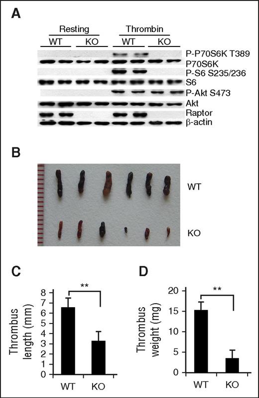 Figure 2. Deletion of mTORC1 in MKs and platelets reduces susceptibility to venous thrombosis in mice. (A) Western blot analysis of activated or resting platelets from platelet-specific Raptor-deletion (KO) or wild-type (WT) mice for Raptor, P-S6, and P-P70S6K expression. A typical result of platelets from 3 different mice is shown. Images (B), lengths (C), and weights (D) of thrombi that developed in the IVC 48 hours after ligation were measured in 12-month-old WT and Raptor KO mice (n = 6). Values represent mean ± SE. **P < .01.