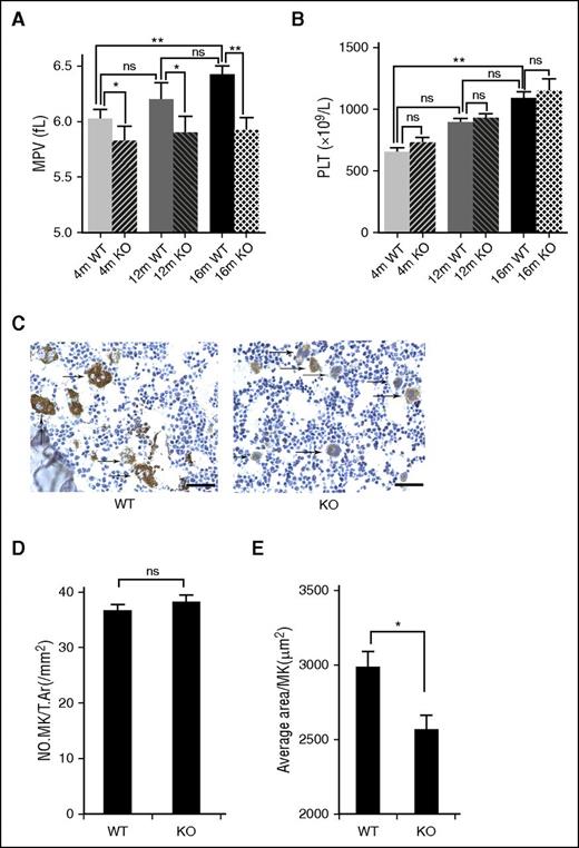 Figure 5. Deletion of mTORC1 suppresses age-associated elevation of MPV and MK size in mice. (A) Complete blood count analysis of 4-, 12-, and 16-month-old WT and Raptor KO mice. MPV (A) and platelet (PLT) (B) counts are shown (n = 8). Values represent means ± SEM; *P < .05; **P < .01. (C) VWF IHC staining of femur bone sections from 4- and 12-month-old WT and Raptor KO mice. Bar represents 100 μm. Quantification of number, no. MK/T.Ar(/mm2), (D) and MK size (E). *P < .05.