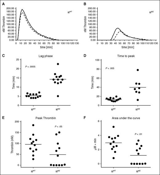 Figure 3. Determination of the activation of fII in fIIWT and fIIMZ plasmas. To evaluate the activation potential of fII in either fIIWT or fIIMZ plasma, we used thrombin generation assays to assess fIIa/fIIaMZ generation over time. Representative thrombin generation curves from fIIWT (A) and fIIMZ (B) plasma. Time to the start of thrombin generation was significantly delayed in fIIMZ plasma (C), as well as time to peak thrombin generation (D). Peak fIIa/fIIaMZ generation was also significantly decreased in the fIIMZ animals (E). Of note, plasma from 4 fIIMZ animals did not have any appreciable (meizo)thrombin generation. Therefore, they were excluded from the time-to-peak (meizothrombin) analysis. Total fIIa/fIIaMZ generation, as represented by area under the curve, was also significantly reduced in fIIMZ plasma compared with fIIWT plasma (F).