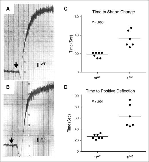 Figure 4. Platelet aggregation in fIIMZ animals. Platelet aggregation in PRP derived from either fIIWT or fIIMZ animals in response to thromboplastin was determined. Fibrin polymerization was blocked with Gly-Pro-Arg-Pro. There was no qualitative difference between fIIWT and fIIMZ platelet aggregation (A and B, respectively). However, a modest but statistically significant difference was noted in time to shape change (as determined by negative deflection, C) and time to positive deflection (D).