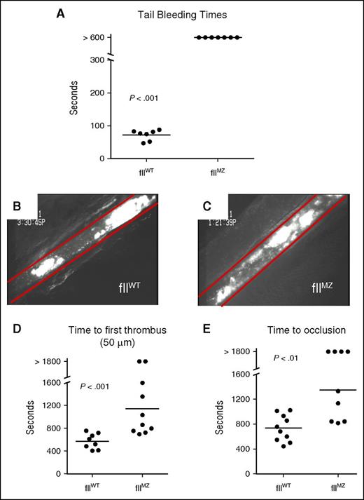 Figure 5. Impaired hemostasis and thrombus formation in fIIMZ animals. (A) In a standard tail bleeding time analysis, fIIWT animals all achieved hemostasis, whereas no fIIMZ mice had cessation of bleeding during the 10-minute window of evaluation. In ferric chloride mesenteric arteriole injury, fIIWT animals developed occlusive thrombi (B). However, although fIIMZ mice formed platelet aggregates, these were unstable and embolized, frequently without progression to occlusion of the vessel (C). FIIMZ animals also exhibited a prolonged time to first thrombus formation (D) and prolonged time to occlusion (E).