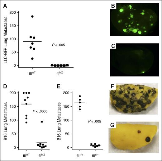 Figure 7. Diminished experimental tumor metastasis in fIIMZ animals. Cohorts of fIIWT and fIIMZ animals were challenged with an IV bolus of LLCGFP. Two weeks later, metastatic foci in the lung were determined. A substantial, statistically significant diminution in the number of lung metastases was noted in the fIIMZ animals compared with fIIWT mice (A). FIIWT animals had prominent metastatic foci (B), whereas many fIIMZ animals demonstrated few, if any, metastases (C). Cohorts of fIIWT and fIIMZ animals were challenged with IV bolus of B16 melanoma. Eighteen days later, metastatic foci in the lung were determined. As was seen with LLC, fIIMZ animals had significantly fewer metastatic foci when compared with fIIWT mice (D). The same pattern was found when comparing fIIWT mice with mice with 50% prothrombin (fII+/−) (E). Numerous metastatic foci were seen in fIIWT animals (F), whereas metastases were rare in fIIMZ mice (G).