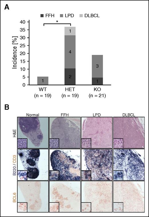 Figure 5. FBXO11 deletion in mice leads to lymphoproliferative disease. (A) Incidence of florid follicular hyperplasia (FFH), lymphoproliferative disease (LPD), and DLBCL in 17- to 18-month-old FBXO11+/+-Cγ1cretg/+ (WT), FBXO11fl/+-Cγ1cretg/+ (HET), and FBXO11fl/fl-Cγ1cretg/+ (KO) mice. N = number of analyzed mice; *P < .05 (1-way ANOVA). (B) Lymph node sections representative of no pathology (normal), FFH, LPD, and DLBCL were stained with hematoxilin/eosin (H&E), B220 (blue) and CD3 (brown), or BCL6 as indicated. Images were acquired using 10× and (for the insets) 20× objectives leading to an overall magnification of ×100 and ×200, respectively.