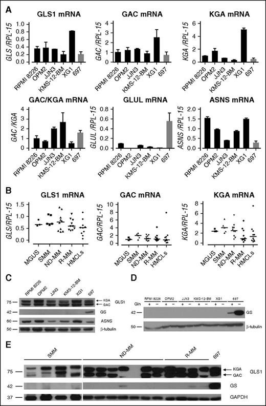 Figure 2. MM cells exhibit high expression of GLS1 but not GS. (A) GLS1, GAC, KGA, GLUL, and ASNS expression was analyzed by real-time PCR in HMCLs and 697 cells. Gene expression was normalized to the expression of RPL-15. GAC/KGA mRNA was also reported. Means plus SD of 3 experiments with 2 determinations each are shown. (B) GLS1, GAC, and KGA expression in primary CD138+ cells, purified from 3 MGUS, 5 SMM, 11 ND-MM, and 10 R-MM patients was evaluated with real-time PCR. Lines represent median values. (C) Western blot of GLS1, GS, and ASNS expression by HMCLs and 697 cells. β-tubulin was used for loading control. (D) GS expression in HMCLs and 697 cells incubated for 19 hours in the presence of 4 mM Gln (+) or in the absence of the amino acid (−). (E) GLS1 and GS expression was evaluated by Western blot in CD138+ cells purified from 4 SMM, 7 ND-MM, and 4 R-MM patients; 697 lysate was used as positive control. GAPDH was used for loading control.