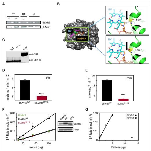 Figure 4. Biliverdin IXβ reductase S111L characterization. (A) BLVRB expression in gel-filtered platelets (10 μg/lane) from representative cohorts that are wild type (−/−) or heterozygous (+/−) for mutant BLVRB462C→T. (B) Schematic globular structure displays BLVRBS111L mutation (green) within the single BV/NAD(P)H binding fold, with higher-resolution ribbon structures (insets) modeled to predict mutant Leu111 or native Ser111 on BV or NADPH interactions; note that Ser111 is uniquely positioned for recognition and/or proton transfer within the Rossmann binding fold, with predicted proximity interference by the hydrophobic Leu111 aliphatic isobutyl side chain. Models were generated using PYMOL software,28 based on NADP/mesobiliverdin IVα ternary (Protein Data Bank ID code 1HE3) and NADP/flavin mononucleotide ternary (Protein Data Bank ID code 1HE4) complexes. (C) Immunoblot of purified recombinant enzymes after thrombin cleavage and glutathione affinity depletion of the GST (glutathione-S-transferase) carrier (50 ng/lane). (D-E) Recombinant BLVRBWT and BLVRBS111L were used for flavin reductase (100 μM flavin mononucleotide) or BVR (20 μM BV dimethyl esters) specific activity determinations15 (N = 6, expressed as mean ± SEM); **** P < .00001. (F) Solubilized lysates from Lv-infected HEK293 cells were used for BVR activity in the presence of 20 μM BV dimethyl esters (N = 3); *P < .05; immunoblot of Lv-infected HEK293 cells (20 μg/lane) is shown. (G) BVR activity assays using recombinant BLVRBWT or commercially available BLVRA.