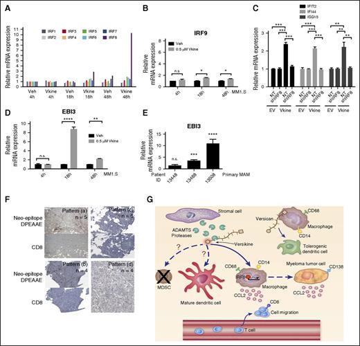 Figure 2. Versikine acts through IRF8 to promote transcription of ISGs. (A) IRF transcription in MM1.S cells, following 48 hours of coculture with THP-1 macrophages in the presence of 0.5 μM versikine (Vkine) or vehicle (veh). Expression is normalized to veh-only levels at 4 hours. (B) IRF9 mRNA levels in MM1.S cells cocultured with THP-1 macrophages in the presence of 0.5 μM versikine (gray bars) or vehicle (black bars) for indicated time lengths. (C) THP-1 cells expressing Vkine or an empty-vector (EV) control were transduced with control lentivirus (NT) or lentivirus expressing short hairpin (shRNA) targeting IRF8 (shIRF8) (see supplemental Figure 3 for validation of IRF8 knockdown at the protein level). Versikine-mediated induction of 3 ISGs shown was measured in the presence and absence of IRF8. (D) EBI3 transcription in MM1.S cells cocultured with THP-1 macrophages and treated with 0.5 μM versikine (gray bars) or vehicle (black bars) for indicated time lengths. (E) RT-PCR analysis for EBI3 transcripts in patient-derived, freshly explanted MAM treated with 1 μM versikine for 12 hours. Relative expression is normalized to vehicle-only control (= 1). (F) Staining of human myeloma bone marrow core biopsy consecutive sections with antibodies against neoepitope DPEAAE generated by V1-VCAN cleavage at Glu441-Ala442 and T-cell marker CD8. DPEAAE constitutes the C terminus of versikine. Four patterns of staining were observed in 19 informative punches: Pattern (a): intense/moderate VCAN proteolysis-CD8 infiltration/aggregates (>5 CD8+ cells in cluster). Pattern (b): intense/moderate VCAN proteolysis-CD8 poor (single/doublet CD8+ cells sparsely distributed within tumor). Pattern (c): weak/focal VCAN proteolysis-CD8 poor (single/doublet CD8+ cells sparsely distributed within tumor). Pattern (d): absent VCAN proteolysis-CD8 poor (single/doublet CD8+ cells sparsely distributed within tumor). (G) Proposed immunomodulatory roles of VCAN proteolysis in the myeloma microenvironment. Whereas intact VCAN is thought to exert tolerogenic activities through TLR2 binding on antigen-presenting cells, its proteolytic product, versikine, may promote immunosurveillance through IRF8-mediated effects on antigen-presenting cells and tumor cells. Currently untested hypotheses are represented by broken lines. *P < .05, **P < .01, ***P < .001, ****P < .0001.