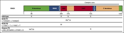 Figure 1. Scheme of RAG1 protein and mutations. WT human RAG1 consists of 1043 amino acids and includes an N-terminus domain, really interesting new gene (RING) finger sequence, zinc finger sequences zinc finger A (ZFA) and zinc finger B (ZFB), the catalytic core, which contains the nonamer- and heptamer-binding regions, and a C-terminus domain. The amino acid positions affected by mutations identified in patients with SCID (P1 and P2) and with OS (P3), and the respective consequences on amino acid sequence are shown. P1 and P2 were homozygous for a frameshift (N476Kfs*16) and a missense (R394W) mutation, respectively. P3 was compound heterozygous for a missense (E722K) and a frameshift (K86Vfs*33). For the latter, an alternative start codon can be used resulting in an N-terminus truncated protein with normal sequence from Met183 onward with cytoplasmic localization. HBR, heptamer-binding region; NBR, nonamer-binding region.