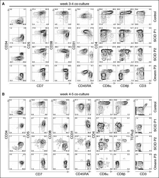 Figure 4. In vitro T-lineage differentiation of control and SCID iPSC lines. Flow cytometric analysis of T-lineage developmental progression of control- and patient-derived cells. iPSCS were allowed to differentiate for 8 days into embryoid bodies, and magnetic bead-purified CD34+ cells were cocultured with OP9-DL-4 cells. (A) Cells from P1 and P2 with SCID, and from P3 with OS attained normal expression of early markers of T-lineage differentiation (CD7, CD5, and CD38) upon 3 to 4 weeks of coculture with OP9-DL-4 cells. (B) After 4 to 5 weeks of coculture, cells from a healthy control progress to the CD4+ CD8αβ+ DP stage of differentiation, with the appearance of CD3+ TRA/TRB+ cells. By contrast, SCID- and OS-derived cells were mostly blocked at the CD7+ CD31−/+ CD45RA+ stage of differentiation, with a virtual absence of CD4 and CD8α/β expression, and lack of CD3+ cells. In (A-B), cells were pre-gated for lymphocytes (SSCxFSC), DAPI-, and CD45+. DAPI, 4′,6-diamidino-2-phenylindole; FSC, forward scatter; SSC, side scatter.