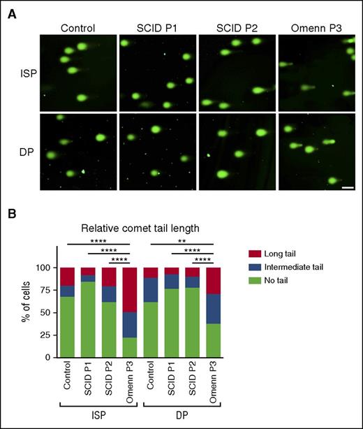 Figure 5. Accumulation of single- or double-stranded DNA breaks. (A) Alkaline single cell gel electrophoresis (Comet assay) of CD4+CD8− (ISP) and CD4+CD8+ (DP) subpopulations for control, SCID P1, P2, and OS P3 cells. DNA was visualized by SYBR Gold. The scale bar corresponds to 100 μm. Tail lengths were measured and summarized in (B). ****P < .0001; **P < .01.