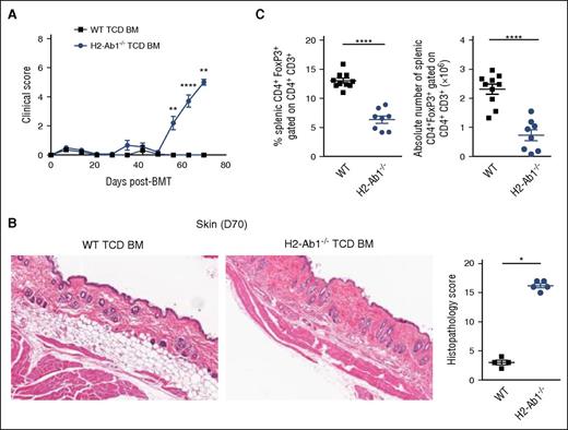 Figure 2. MHC class II deficiency induces chronic GVHD with associated reduced Treg number. (A) Clinical scores of lethally irradiated B6D2F1 recipients transplanted with 5 × 106 TCD BM cells from B6.H2-Ab1−/− or WT donor mice (n = 14-15, 3 experiments). (B) Representative images of H&E staining of skin taken at day 70 after BMT and GVHD histopathology scores quantified in the skin (n = 4-5, 1 experiment). (C) The frequency and number of CD3+CD4+FoxP3+ cells were analyzed in the spleen of the recipients at day 70 after BMT (n = 8-10, 2 experiments).