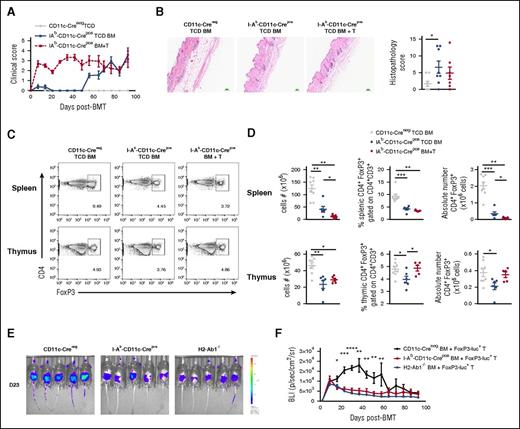 Figure 3. MHC class II deficiency within cDCs induces Treg deficiency and cGVHD. (A) Clinical scores of lethally irradiated B6D2F1 recipients transplanted with 5 × 106 TCD BM cells with (BM+T) or without (TCD) 0.5 × 106 CD3+ T cells from CD11c Creneg or I-Ab CD11c Crepos donor mice (n = 8, 1 experiment). (B) Representative images of H&E staining of skin taken at day 93 after BMT and GVHD histopathology scores quantified in the skin (n = 6-8, 1 experiment). (C) Representative dot plots of CD4+FoxP3+ cells gated on CD3+CD4+ T cells in spleen and thymus at day 94 after BMT. (D) Cell numbers, frequency, and absolute numbers of CD3+CD4+FoxP3+ Treg cells in spleen and thymus (n = 5-8, 1 experiment). (E) Lethally irradiated B6D2F1 recipients were transplanted with 5 × 106 TCD BM cells from CD11c Creneg, I-Ab CD11c Crepos, or B6.H2-Ab1−/− donor mice with 0.5 × 106 FoxP3-luc+ CD3+ T cells. Representative images of the FoxP3-luc+CD3+ T cells are represented in the whole mice at day 23 after BMT. (F) The bioluminescence (BLI, ph s−1 cm−2 sr−1) is represented and followed over time after BMT (n = 10, 2 experiments). Each dot corresponds to 1 individual mouse.