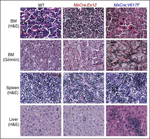 Figure 4. Histopathology of transgenic mice and controls. Mice were euthanized 24 weeks after pIpC injection. H&E staining of BM, spleen, and liver, as well as reticulin-staining (Gömöri) of BM are shown (original magnification ×400). H&E, hematoxylin and eosin.