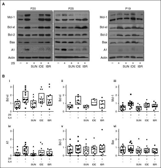 Figure 6. Microenvironment survival signals induce patient-specific changes in expression of Bcl-2 family proteins that was prevented by sunitinib but not ibrutinib or idelalisib. Comparison of protein levels for unstimulated CLL cells (−) and 2S- or IL4-stimulated cells (+) before and after treatment with 1 µM sunitinib (SUN), idelalisib (IDE), and ibrutinib (IBR). Protein lysates for stimulated patient cells (n = 13 for 2S stimulation, n = 6 for IL4 stimulation) collected 18 to 20 hours after drug treatment were analyzed by immunoblotting using antibodies to the antigens indicated. (A) Representative results for patients P20, P25, and P19. (B) Quantification of relative protein levels for Bcl-xl (i-ii), Mcl-1 (iii), A1 (iv), Bcl-2 (v), and Bax (vi) by analysis of chemiluminescence signals recorded using a CCD camera corrected to the intensities obtained with the β-actin antibody using NIH ImageJ 1.48p software. Data are for 13 patients in subpanels i, iii, iv, v, and vi and 6 patients in subpanel ii; boxes indicate 25th to 75th percentile with the mean indicated as a line. For sunitinib treatment in 2S-stimulated cells, 21 patients were analyzed by immunoblotting (data not shown, significance tests in supplemental Table 2).