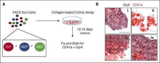 Figure 1. Use of the dual CFU-Mk/E assay to quantify bipotent MEPs. (A) Schematic of the dual CFU-Mk/E assay to determine Mk/E potential of FACS-sorted populations. Candidate MEPs are plated in a collagen-based colony assay with EPO, TPO, SCF, IL-3, and IL-6 to promote growth of megakaryocyte and erythroid colonies. After 13 to 15 days of culture, colonies are fixed and stained for CD41a (Mk specific) and GlyA (E specific). (B) Representative images of different colony types are shown. (i) Typical BFU-E stains for GlyA (purple) only. (ii) CFU-Mk stains for CD41a (red) only. (iii-iv) Two representative CFU-Mk/E colonies show prominent CD41a+ Mk within a burst of GlyA+ cells. Scale bar, 100 µm.