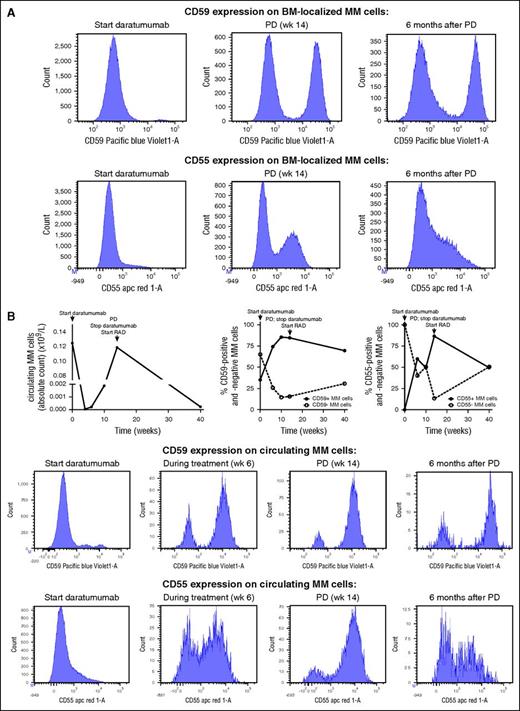 Figure 5. Selection of populations of MM cells with high expression of complement-inhibitory proteins during therapy with daratumumab. Two of 21 GEN501 patients had coexisting populations of MM cells, which differed in CD55 and/or CD59 expression. (A) BM-localized MM cells from patient 5 differed in expression levels of CD55 (absent or strongly positive) and CD59 (absent or strongly positive). Bone marrow samples were obtained before start of daratumumab therapy, at the time of progressive disease (PD), and 6 months after the last daratumumab infusion. Flow cytometry histograms for these samples are shown. (B) Similarly, circulating MM cells from patient 5 also differed in expression levels of CD55 (absent or strongly positive) and CD59 (absent or strongly positive). Serial blood samples were obtained during daratumumab monotherapy and during the treatment given after development of progressive disease (PD). Longitudinal data representation of absolute circulating MM cell counts over time and of the frequency of the different subpopulations based on complement-inhibitory protein expression. Representative histograms are also shown for this patient. RAD, lenalidomide, adriamycin, and dexamethasone.