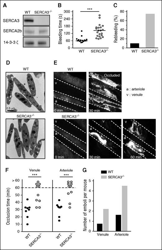 Figure 1. Characterization of hemostasis and in vivo thrombosis in SERCA3−/− mice. (A) Western blot of SERCAs in mouse platelets. Control (WT) and SERCA3−/− mouse platelets were collected and solubilized and subjected to sodium dodecyl sulfate polyacrylamide gel electrophoresis, prior to transfer to nitrocellulose and detection by antibodies specific for SERCA3 or SERCA2b.28 After addition of a secondary antibody coupled to horse radish peroxidase, bands were revealed by chemiluminescence. The 14-3-3ζ adaptor was used as an internal standard for normalization. Note the absence of SERCA3 in SERCA3−/− platelets and the same levels of SERCA2b in both control and SERCA3−/− platelets. (B) Tail bleeding time. Tail bleeding was performed as indicated in “Materials and methods,” and bleeding time assessed both on control (WT) and SERCA3−/− mice. Results are presented as mean ± SEM, using the Student t test; ***P < .001. (C) Rebleeding was assessed for 1 minute following initial bleeding arrest. A total of 18 control and 21 SERCA3−/− mice were used. (D) Transmission electron microscopy of resting control and SERCA3−/− platelets. Platelets were subjected to standard transmission electron microscopy. Upper panel, control (WT); lower panel, SERCA3−/− platelets. The scale bar (0.5 µm) is shown in the lower left corner of the WT panel. (E) Kinetics of in vivo ferric chloride-induced thrombosis of mesenteric vessels. Venules (v) or arterioles (a) are shown by fluorescence microscopy (limits outlined with white dashed lines), thrombi being visualized by rhodamine 6G–labeled platelets. Images at 0, 30, and 60 minutes are shown. (F) Quantification of thrombus formation. Time to occlusion was noted for 18 control (WT, closed circles) and 21 SERCA3−/− (open circles) mice up to 60 minutes, the maximal time assessed. Results were analyzed using 1-way ANOVA followed by Tukey’s multiple comparison test; ***P < .001. (G) Quantification of emboli. The number of emboli shedding from thrombi was assessed for 60 minutes, both in venules and arterioles of control and SERCA3−/− mice.