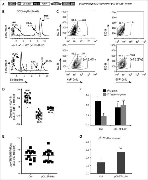 Figure 1. Increased HbF and reduced HbS synthesis after treatment with pCL-ZF-Ldb1. (A) Lentiviral construct carrying ZF-Ldb1 and the GFP genes expressed under the ankyrin promoter (Pr) via an internal ribosomal entry site (IRES). (B) Percentage of HbF, HbS, and HbA2 measured by high-performance liquid chromatography (HPLC) in representative erythroid cells untreated (top) or treated with ZF-Ldb1 (bottom). The transduced cells have, on average, 0.7 copies of viral molecules integrated per genome. (C) Changes in percentage of cells expressing HbF (left panels) and GFP (right panels), measured by flow cytometry. (D) Overall percentages of HbF, HbS, and HbA2 changes in SCD samples treated with pCL-ZF-Ldb1 (n = 10, 5 samples were duplicated; average VCN = 1.2). (E) Hb (F + S + A2) content in erythroid cells with or without pCL-ZF-Ldb1. (F) Ratio of β- or γ-globin chains over α-globin chains. The quantity of the globin chains (in μg) is measured via liquid chromatography under denaturing conditions (**P < .05). (G) Ratio of γ/β-like chains measured in 250 000 erythroid sickle cells untreated or treated with pCL-ZF-Ldb1 (n = 5, VCN = 1.6; ***P < .005 and **P < .05). FSC-H, forward scatter height; LTR, long terminal repeat; pA, polyadenylation signal; pCL, vector backbone; VCN, vector copy number; WPRE, woodchuck hepatitis virus posttranscriptional regulatory element.