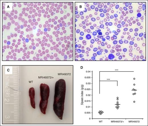 Figure 1. MRI49372 macrocytic anemia and splenomegaly. (A) Representative light microscopy image of Wright-Giemsa–stained WT thin smear. (B) Representative light microscopy image of Wright-Giemsa–stained Ampd3T689A thin smear. (C) Representative spleens from WT, MRI49372/+, and MRI49372 mice. (D) Spleen index, calculated as spleen weight (g)/mouse weight (g) for WT (n = 7), MRI49372/+ (n = 8), and MRI49372 (n = 7). Black bars represent median. ***P < .001. P values calculated using the Student t test.