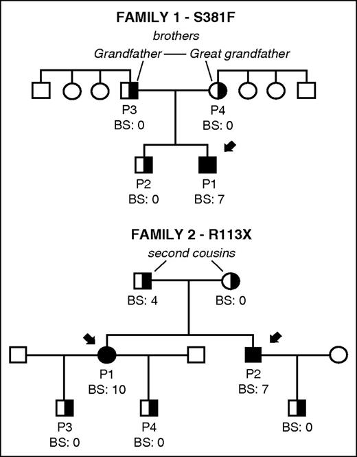 Figure 3. Family pedigrees and bleeding scores in 2 unrelated families carrying novel mutations S381F and R113X in CalDAG-GEFI. The index cases in each family are indicated with black arrows. Bleeding in patients and available family members was evaluated and a bleeding score was assigned by using the International Society on Thrombosis and Haemostasis Bleeding Assessment tool.16 Filled and partially filled black symbols indicate homozygosis and heterozygosis for the corresponding mutation in RASGRP2. Other family members (white symbols) were not available for study.