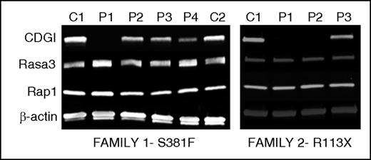 Figure 4. Novel mutations R113X and S381F severely affect the expression of CalDAG-GEFI. Immunoblot analysis for CalDAG-GEFI (CDGI), Rasa3, Rap1, and β-actin in platelet lysates from carriers of the indicated mutations in CalDAG-GEFI. Left: p.S381F (P1 homozygous; P2, P3, P4 heterozygous); Right: p.R113X mutation (P1 and P2 homozygous; P3 heterozygous). Protein expression in lysates from healthy and unrelated controls (C) analyzed in parallel is also shown.