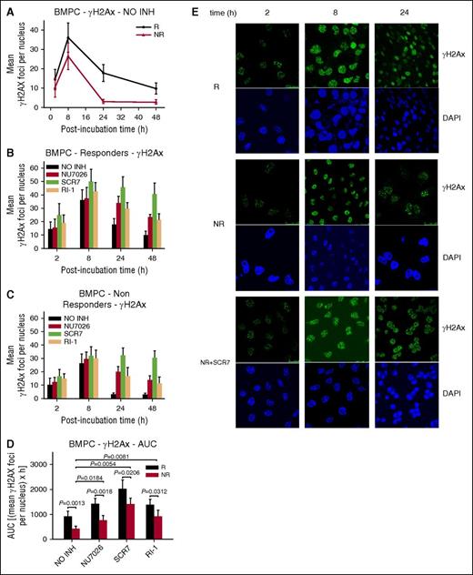 Figure 4. Formation of γH2AX foci in BMPCs. (A) γH2AX foci formation 2 to 48 hours after treatment with melphalan alone. Formation of γH2AX foci 2 to 48 hours after treatment of BMPCs from responders (B) or nonresponders (C) with melphalan in the presence or not of an inhibitor. NO INH, no inhibitor. R, responders; NR, nonresponders. (D) Total amounts of γH2AX foci, expressed as AUC, after treatment with melphalan in the presence or not of an inhibitor. The experiments shown were based on a minimum of 3 independent repeats and the data reported are the mean ± SD of all the patients analyzed. (E) Typical images showing the γH2AX staining at different time points after treatment of BMPCs from 1 representative responder (R) and 1 nonresponder (NR) with melphalan alone or in the presence of SCR7. Upper images, immunofluorescence antigen staining; bottom images, cell nuclei labeled with 4′,6-diamidino-2-phenylindole.