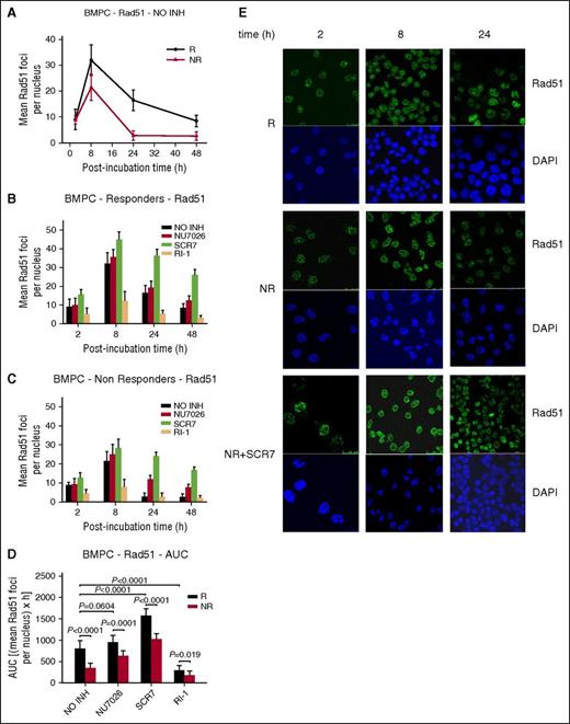 Figure 5. The role of homologous recombination in the repair of melphalan-induced DNA damage in BMPCs. (A) Rad51 foci formation 2 to 48 hours after treatment with melphalan alone. The formation of Rad51 foci 2 to 48 hours after treatment of BMPCs from responders (B) or nonresponders (C) with melphalan in the presence or not of an inhibitor. NO INH, no inhibitor. R, responders; NR, nonresponders. (D) Total amounts of Rad51 foci, expressed as AUC, after treatment with melphalan in the presence or not of an inhibitor. The experiments shown were based on a minimum of 3 independent repeats and the data reported are the mean ± SD of all the patients analyzed. (E) Typical images showing the Rad51 staining at different time points after treatment of BMPCs from 1 representative responder (R) and 1 nonresponder (NR) with melphalan alone or in the presence of SCR7. Upper images, immunofluorescence antigen staining; bottom images, cell nuclei labeled with 4′,6-diamidino-2-phenylindole.