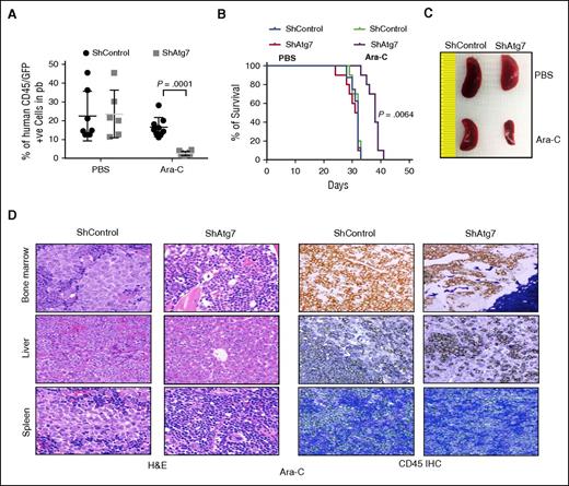 Figure 6. Atg7 knockdown improves antileukemic activity of Ara-C in OCI AML3 in NSG model of engrafting leukemia. NOD-SCID-IL2Rϒ null mice were injected with Atg7 knockdown or ShControl OCI-AML3 (1 × 106) through tail vein and Ara-C (100 mg/kg) administered on days 7, 9, 11, 14, 16, 18, and 24 through intraperitoneal route. At day 29, 50 μL of PB was collected from intraorbital bleeding and tumor burden was measured by detection of double-positive (GFP/human CD45) cells (A). Two mice from each group were euthanized to assess splenomegaly (C) and infiltration of tumor in other organs (D). A plot of overall survival probability, estimated with the Kaplan-Meier method, is shown in (B). Original magnification ×40 for panel D.