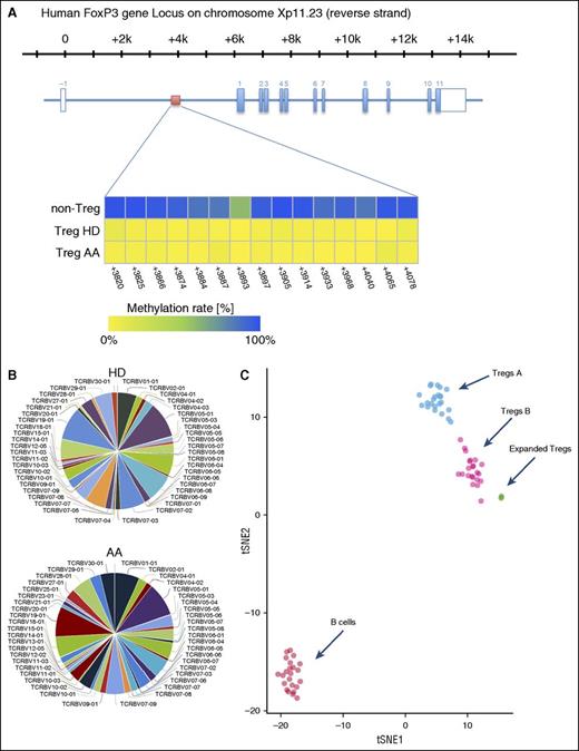 Figure 6. (A) Overview of the human FOXP3 gene locus with the exon/intron structure in blue and the TSDR region in red. The lower panel shows the methylation statues of TSDR in HD and AA expanded Tregs compared with non-Tregs. (B) Expanded Tregs were polyclonal in both AA and HD patients. The normalized Shannon entropy of expanded Treg repertoire was used to calculate the degree of clonality, which, on average, was 0.12. (C) Because we did not succeed in isolating enough Treg A and Treg B cells from AA patients for individual in vitro expansion because of the low number of Tregs in these patients, the composition of in vitro expanded Tregs were assessed by calculating the Euclidian distance between the mean expression for each parameter in Treg A and B, which was calculated in 24 Treg A and B (5 HD and 19 AA samples) and 5 (2 AA and 3 HDs) in vitro expanded Tregs. B cells were used as an irrelevant control. The following parameters, which showed the highest differences between subpopulations, were used for the Euclidian distance calculation: FOXP3, CD25, CD127, CD45RA, HLA-DR, CCR6, CCR4, CD69, CD27, CXCR3, CD45RO, CD4, CD20, CD95, CD161, CD28, CD152, CD7, CD279, and CD19. t-SNE1 and t-SNE2 were used for distance calculation (see also supplemental Figure 10). viSNE plot of expression centroids for all Treg cell subpopulations, B cells, and expanded Tregs across all samples. Treg A and Treg B cells were automatically gated from 24 individual samples (19 samples from AA patients, 5 HDs) using the automated clustering algorithm FLOCK on a subset of 700 000 cells proportionally selected from all samples. B cells were gated from the same 24 samples in Cytobank. Expanded Tregs were from 3 HDs and 2 AA patients. Expression centroids were computed for each cell population and used as input for the dimensionality algorithm t-SNE as implemented in the tool cyt (see “Methods” for more details). Each dot in the plot represents 1 particular cell population in a particular sample. Expression values were transformed using the asinh function in a cofactor of 5. Using a 1-tailed Welch’s 2-sample t test, we can reject the null hypothesis that the distance between Treg A and expanded Tregs is lower than in Treg B (P < 2.2 × 10−16), which suggests that expanded Tregs are more similar to subpopulation B than A.
