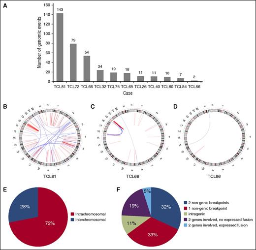 Figure 1. Distribution of 378 genomic events identified by mate-pair sequencing in 11 cases of PTCL, NOS. (A) Number of genomic events per case. (B-D) Representative Circos diagrams illustrating heterogeneity in the degree of complexity of genomic events among PTCLs: (B) high complexity; (C) focally high complexity with multiple rearrangements involving chromosomes 16 and 19 (chromothripsis); and (D) low complexity. (E) Distribution of intrachromosomal and interchromosomal events. (F) Distribution of events based on involvement of genes or nongenic regions and identification of expression fusion transcripts by RNA sequencing.