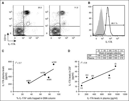 Figure 2. GMA successfully removed IL-17A-producing monocytes from blood. (A) Contour plots of PBMCs that were isolated from the patient’s blood on week (w) 159 before and immediately after GMA were stained intracellularly with an anti-IL-17A antibody in combination with surface marker staining for monocytes (CD14). (B) Histograms of the cells that were trapped in the GMA column on week 159 and stained with antibodies for either IL-17A (black line) or Alexa 647 isotype (gray area). The percentage refers to IL-17A+ cells among PBMCs. (C) Correlation between plasma IL-17A levels and percentage of IL-17A+ cells trapped in the GMA column. (D) Correlation between IL-17A levels in CSF and plasma. CSF was collected 1 to 2 times per year and mostly on occasions separate from when plasma was collected; therefore, panel D includes only 5 time points: 1 time point following a long break in GMA (i), 3 time points with plasma and CSF collection at maximum 1 week apart (ii-iv), and 1 time point ≥6 months after GMA termination (v).