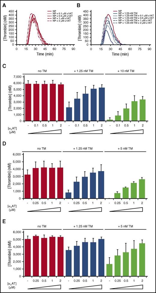 Figure 4. KRK α1AT rescues the effect of soluble TM in normal and factor-deficient human plasma. (A-B) Representative thrombin generation curves showing the effect of KRK α1AT (concentrations indicated) in normal human plasma (NP) in the (A) absence and (B) presence of 1.25 nM soluble TM. Each curve is an average of duplicates. In (B) the no TM control from (A) is shown for reference. (C) Bar graph of total thrombin generation in normal plasma (given as thrombin concentrations) at 0, 1.25, and 10 nM TM, with increasing concentrations of KRK α1AT (up to 2 μM). Each bar is the average of 3 experiments of duplicates, with standard deviation shown by vertical lines. (D) Bar graph of total thrombin generation in fVIII-deficient (hemophilia A) plasma (given as thrombin concentrations) at 0, 1.25, and 5 nM TM, with increasing concentrations of KRK α1AT (up to 2 μM). Each bar is the average of 2 experiments of duplicates with standard deviation shown. (E) Bar graph of total thrombin generation in fIX-deficient (hemophilia B) plasma (given as thrombin concentrations) at 0, 1.25, and 5 nM TM, with increasing concentrations of KRK α1AT (up to 2 μM). Each bar is the average of at least 2 experiments of duplicates, with standard deviation shown.