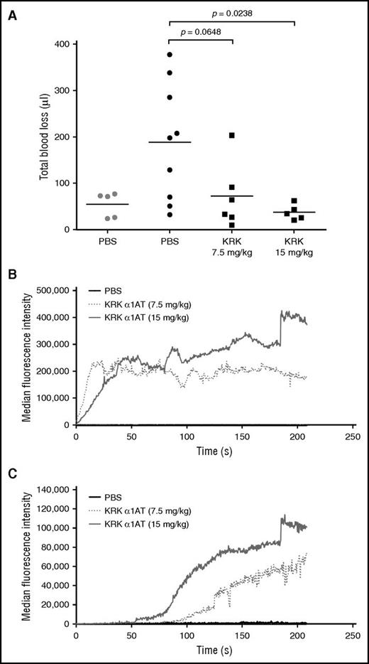 Figure 5. KRK α1AT reduces bleeding and increases platelet and fibrin deposition in hemophilia B mice. (A) Total blood loss of either wt (gray) or hemophilia B (black) mice injected with either PBS (circles), or KRK α1AT (squares) after tail clip. Each data point is from a single mouse. Lines show the average per group. P values were calculated by using an unpaired Student t test. (B-C) Median accumulation of (B) platelets and (C) fibrin over time after laser-induced arteriole injury after administration of PBS (black line; 8 total thrombi, 5 mice) or KRK α1AT (gray-shaded dotted and solid lines; 18 total thrombi, 4 mice at 7.5 mg/kg; 20 total thrombi, 3 mice at 15 mg/kg).