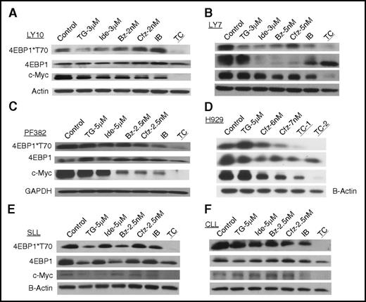 Figure 3. TGR-1202 and carfilzomib synergistically disrupt the 4E-BP1–eIF4F–c-Myc axis. Cell lines, including (A) LY10, (B) LY7, (C) PF382, and (D) H929, and primary cancer cells from patients with (E) SLL and (F) CLL were treated by TG, Ide, Cfz, Bz, and their combinations as indicated for 24 hours. In the H929 cell line, TC-1 and TC-2 indicate TGR at 5 μM in combination with carfilzomib at 6 and 7 nM, respectively. Cell were harvested and processed for western blot analysis using the antibodies against 4E-BP1, c-Myc, β-actin, and glyceraldehyde-3-phosphate dehydrogenase (GAPDH).