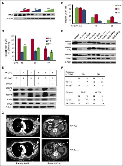 Figure 7. Targeting of CK1ε is required for inhibition of 4E-BP1 phosphorylation, silencing of c-Myc translation, and likely clinical activity in aggressive lymphoma. The following drugs were used: Ide, TG, PF4800567 (PF), Cfz. (A) Western blot analysis of LY7 cells treated with vehicle control (c-), and Ide, TG, and PF at 15, 25, 50 μM for 24 hours. (B) LY7 cells stably transfected with a c-Myc–overexpressing plasmid (M+) or an EV were treated at the indicated concentrations of TG for 24 hours, then processed for Cell Titer Glo to determine viability. The parental LY7 cell without plasmid transfection (NoP) served as an additional control. The protein levels of c-Myc in these samples were demonstrated in supplemental Figure 5A. (C) LY7 cells stably expressing the bicistronic reporter described in Figure 4C were treated with the indicated drugs for 24 hours. R:F Luc ratios from the treatment groups were calculated as a percentage of the untreated control, and represented the efficiency of eIF4F cap-dependent translation regulated at the endogenous 5′ UTR of c-Myc. (D) Western blot analysis of LY7 cells treated by various singles agents and combinations for 24 hours. The numbers in the combinations indicated the drug concentrations in μM. (E) Effects of CK1ε knockdown on the combination of Ide + Cfz. LY7 cells stably expressing the CK1ε targeting shRNA (shRNA+) or the parental untransduced control cells (shRNA−) were treated as indicated for 24 hours and assessed by western blot. (F) Top panel, Response to TGR-1202 as a single agent in all 14 patients with DLBCL enrolled in a phase 1 clinical study. The results of idelalisib were extracted from the publication by Westin et al.34 Bottom panel, Frequency of diarrhea in all 81 patients taking TGR-1202 in the phase 1 study. The results of idelalisib were extracted from the publication by Gopal et al.35 (G) Pre- and posttreatment images of x-ray computed tomography from 2 DLBCL patients treated with TGR-1202.